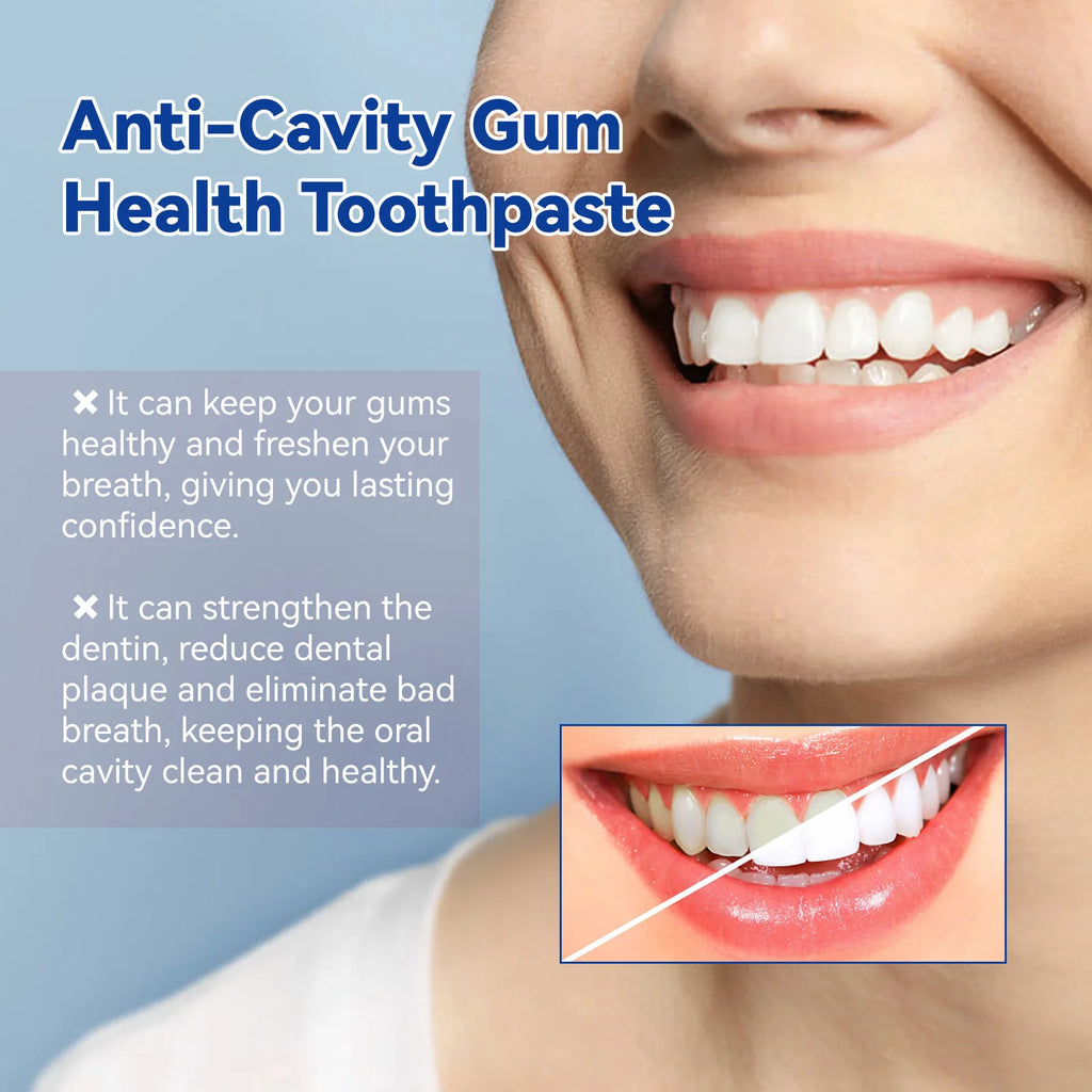 Oralhoe 120g Anti Cavity Toothpaste Repair Gum Health Tartar Deep Cleansing Yellow Teeth Whitening Remove Oral Odor Toothpaste