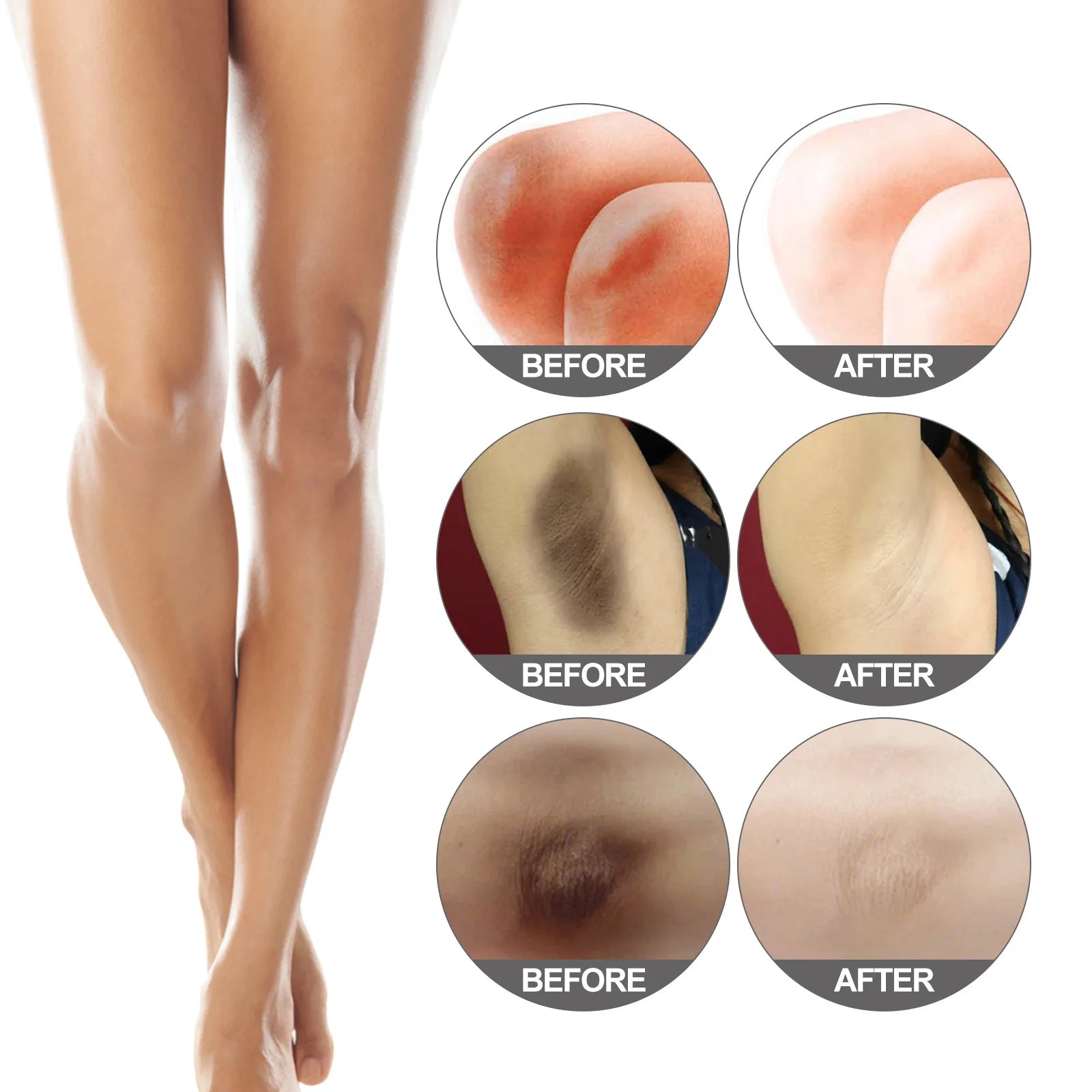 30ml Jaysuing Underarm And Thigh Black Cream Remove Black Spots Melanin Bright White Private Parts Moisturizing Body Lotion