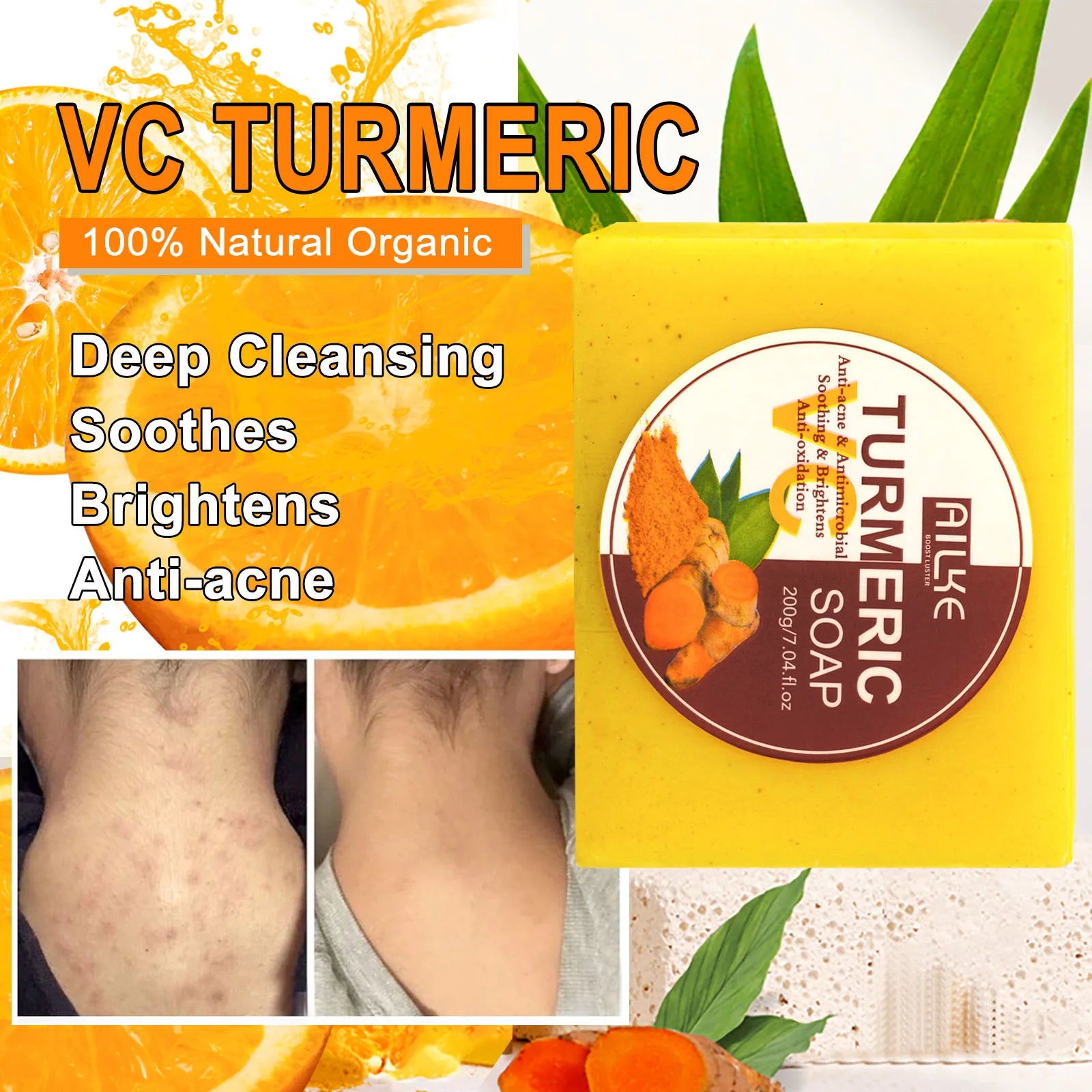 AILKE Aloe Vera Whitening Soap, Remove Acne, Pimples, Skin Radiant, Improve Skin Luster, Vegan Bath Wash for All Skin Types