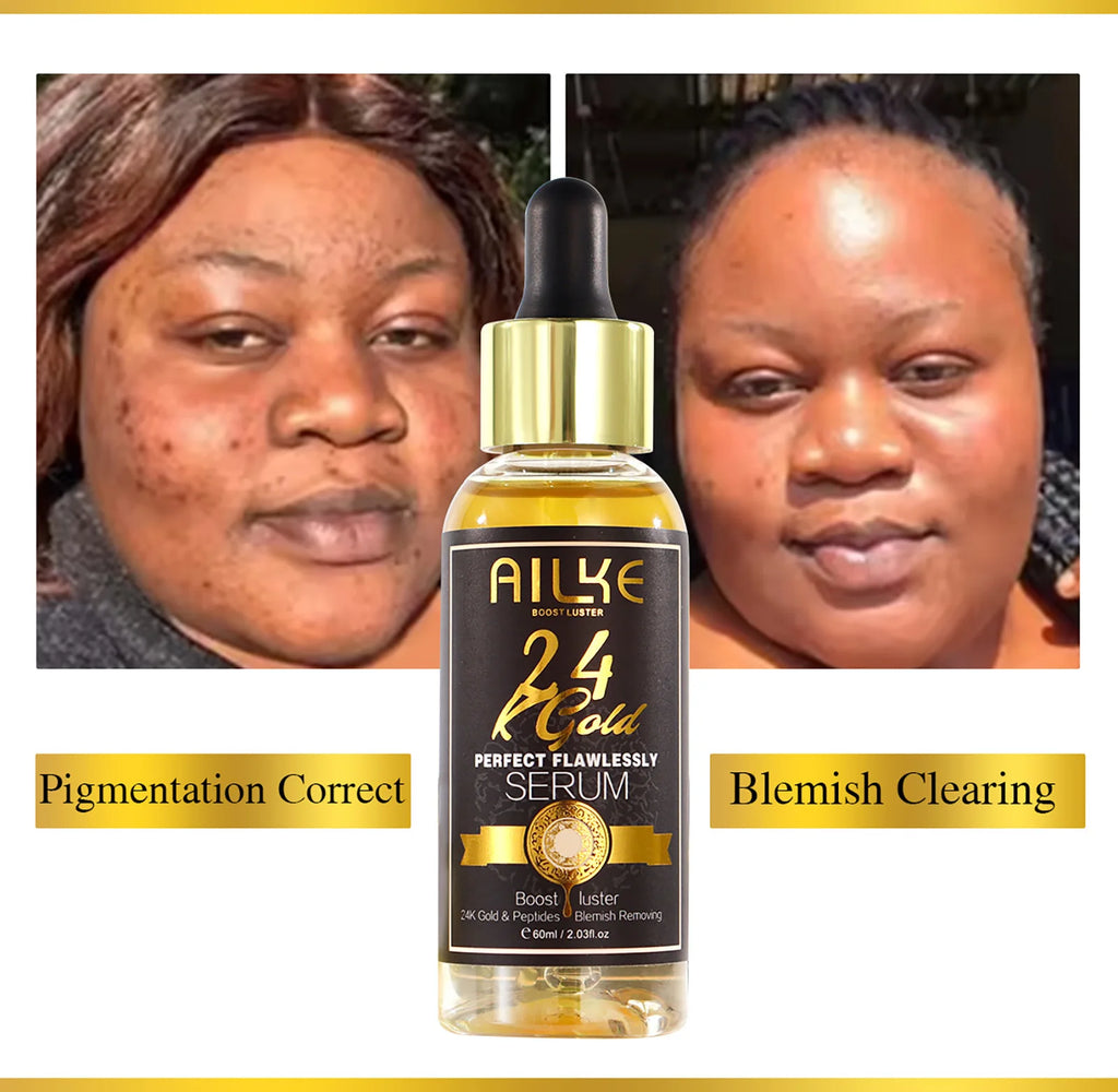 Ailke 24K Gold Collagen Cream Joint Removing Dark Spot Strong Whitening Face Anti Aging Skin Care Set
