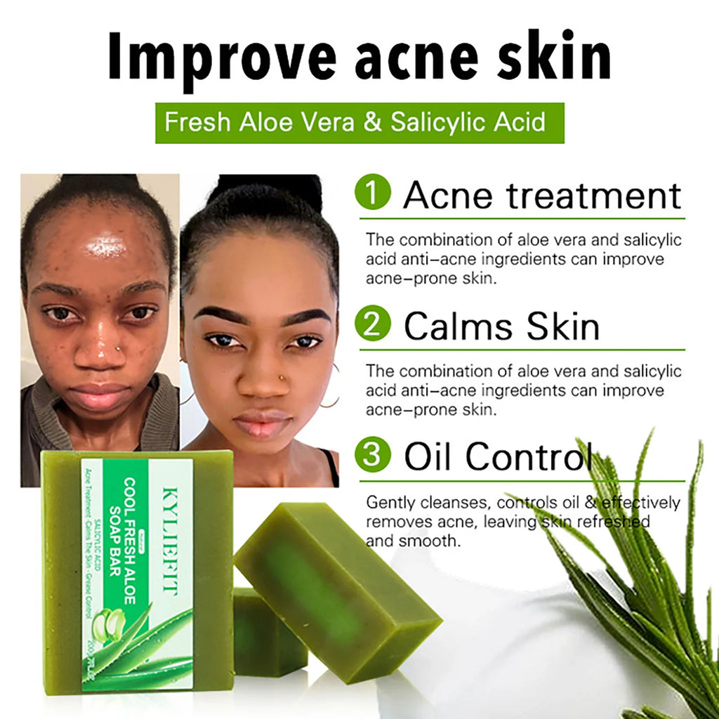AILKE Aloe Vera Whitening Soap, Remove Acne, Pimples, Skin Radiant, Improve Skin Luster, Vegan Bath Wash for All Skin Types