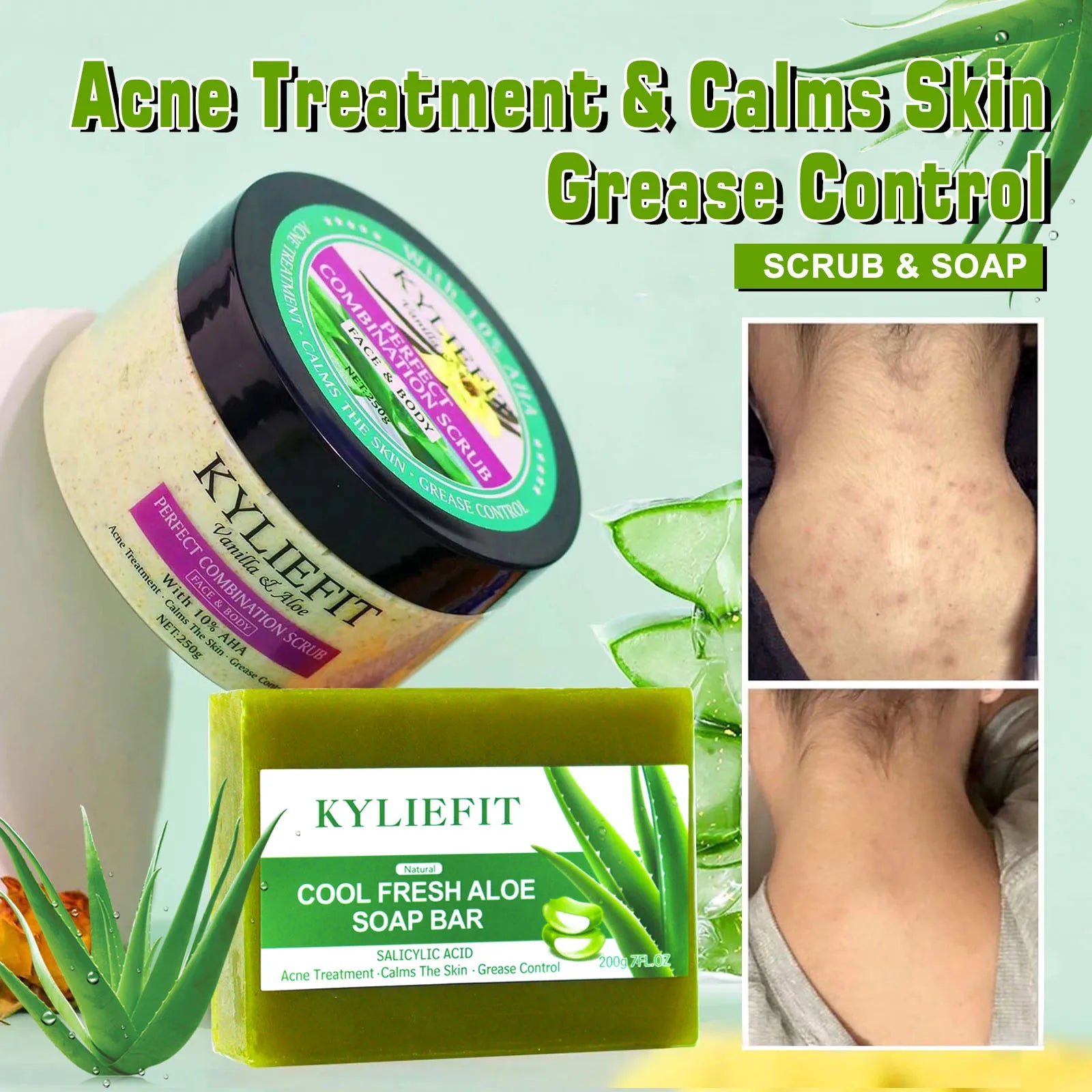 AILKE Aloe Vera Whitening Soap, Remove Acne, Pimples, Skin Radiant, Improve Skin Luster, Vegan Bath Wash for All Skin Types